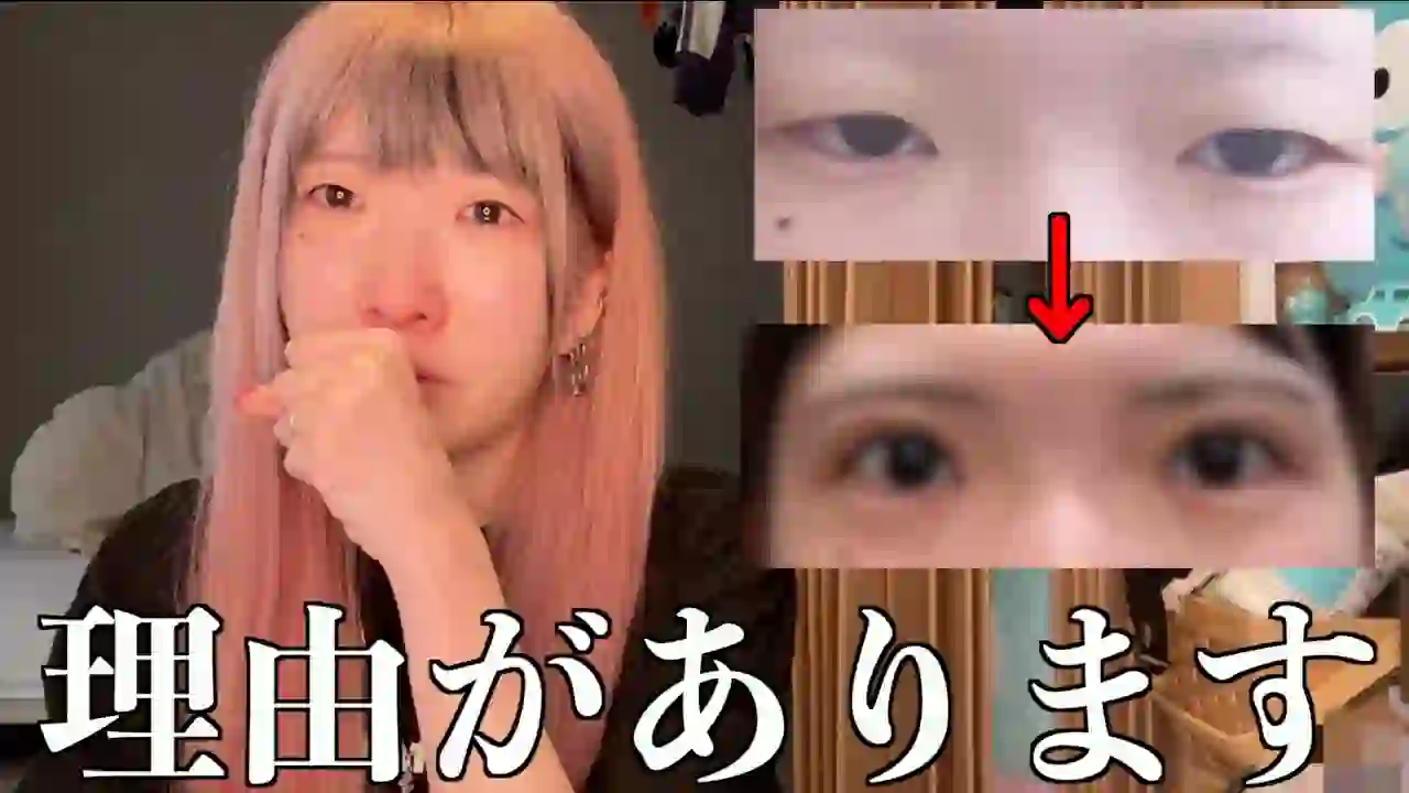 【Announcement】I had double eyelid surgery.